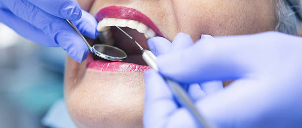 Best Emergency Dentist for Knocked-Out Tooth in Salida Del Sol Estates, TX